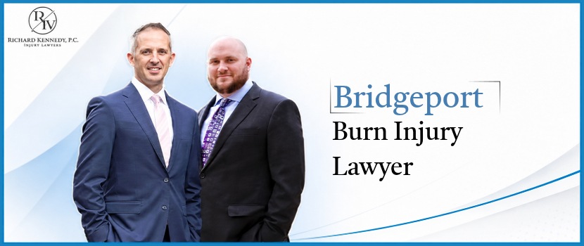 Bridgeport Burn Injury Lawyer-image